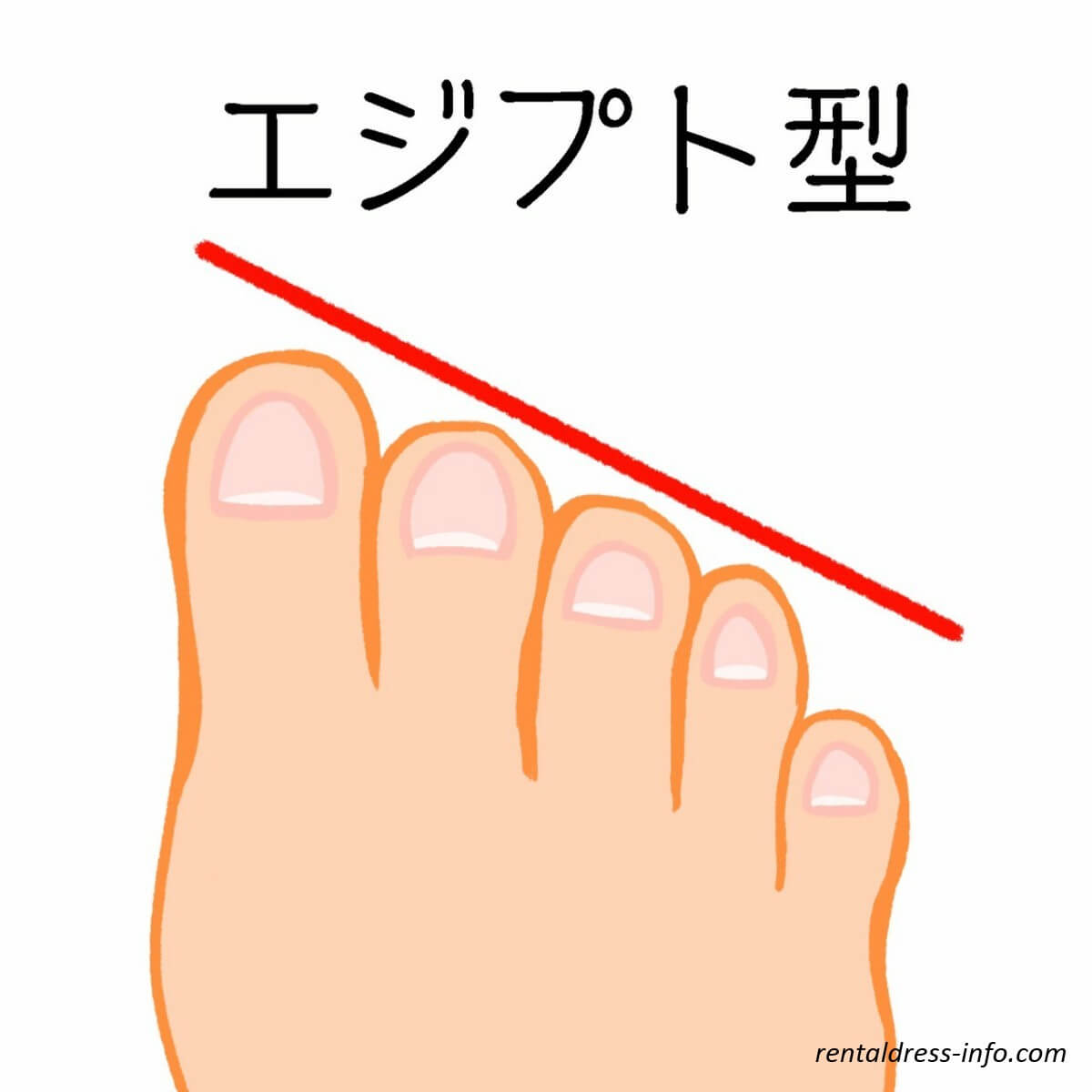 エジプト型